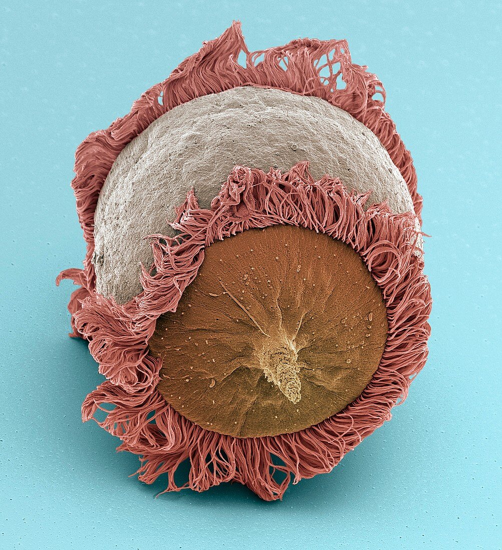 Didinium ciliate protozoan,SEM