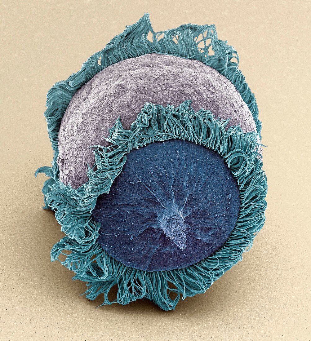 Didinium ciliate protozoan,SEM