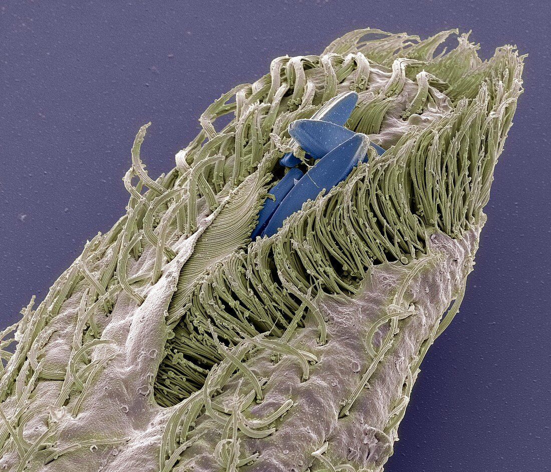 Holosticha ciliate protozoan,SEM