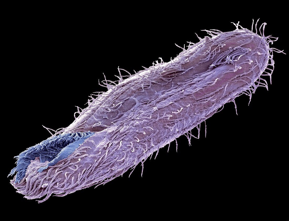 Climacostomum protozoan,SEM