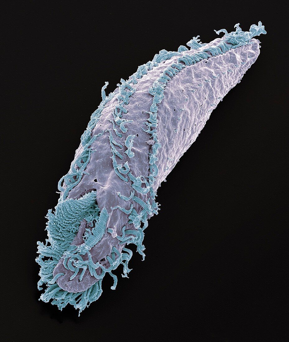 Oxytricha ciliate protozoan,SEM