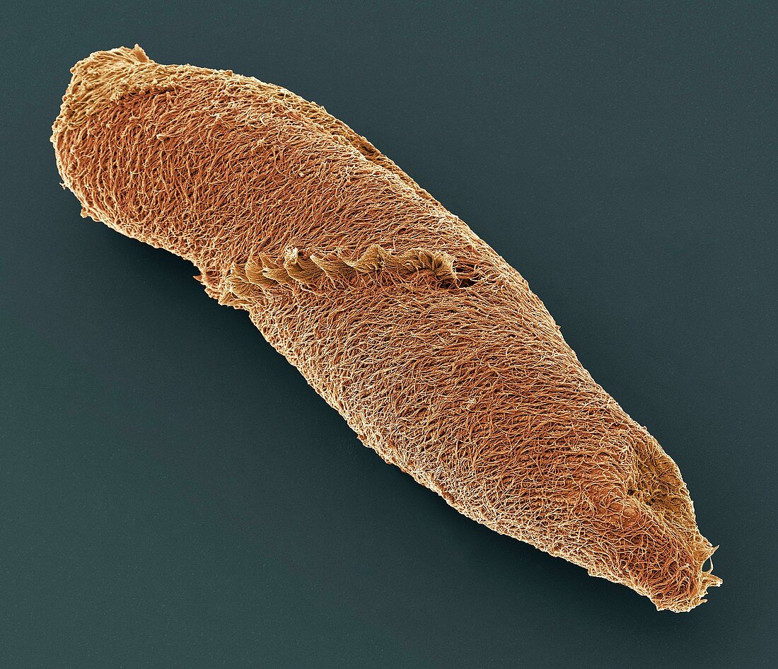 Spirostomum ciliate protozoan,SEM