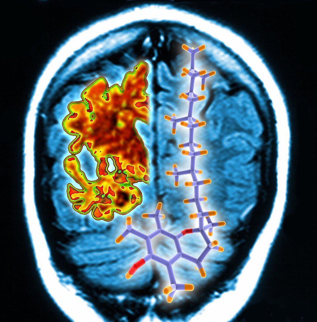 Brain mri scan and vitamin E molecule