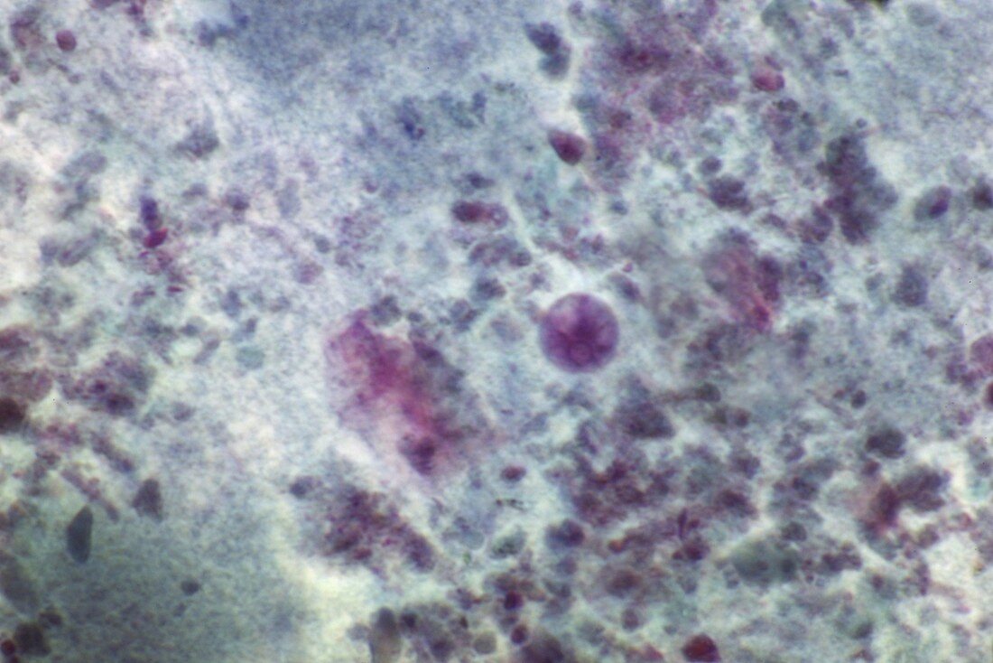 Entamoeba histolytica protozoan cyst