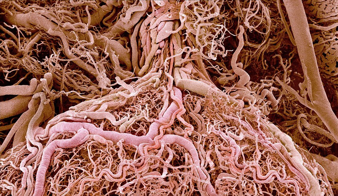 Bladder blood vessels,SEM