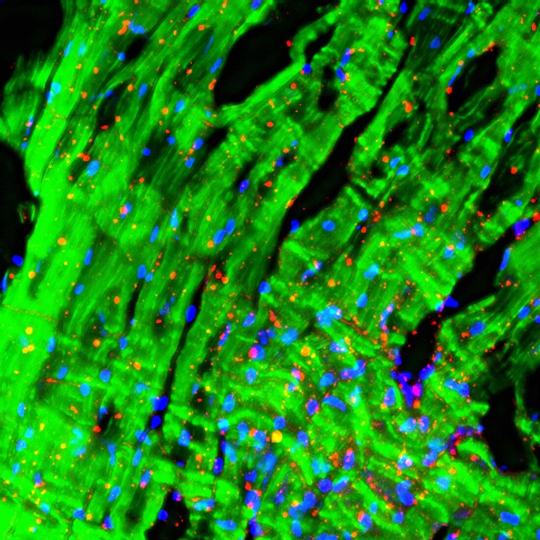 Heart muscle,fluorescence micrograph