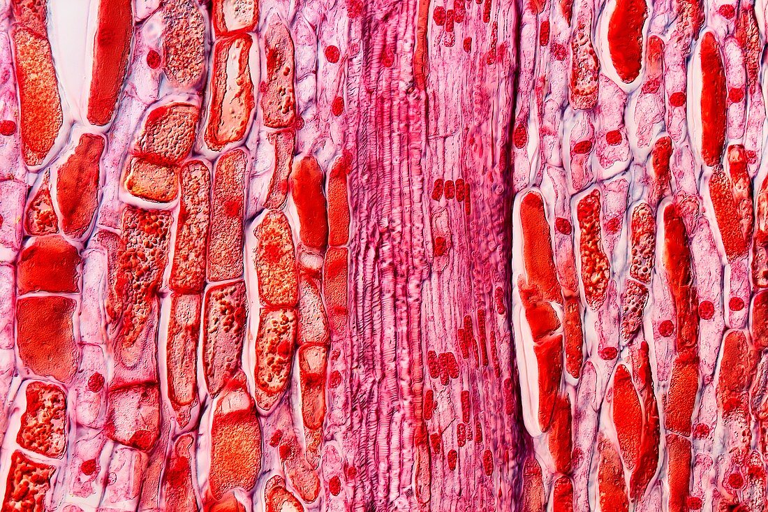 Pine cone tissue,light micrograph