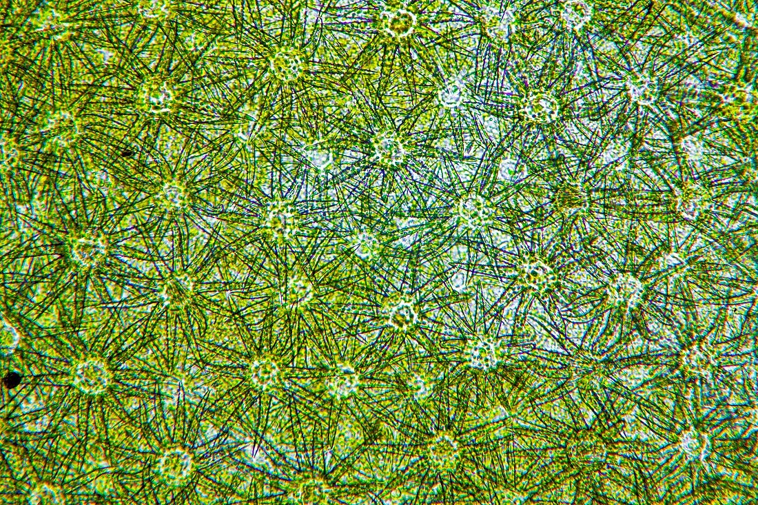 Deutzia monbeigii ovary,light micrograph