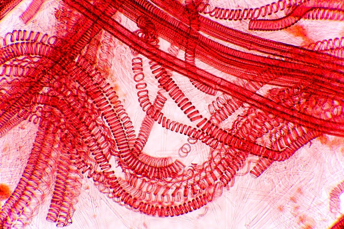Plant vascular bundles,light micrograph