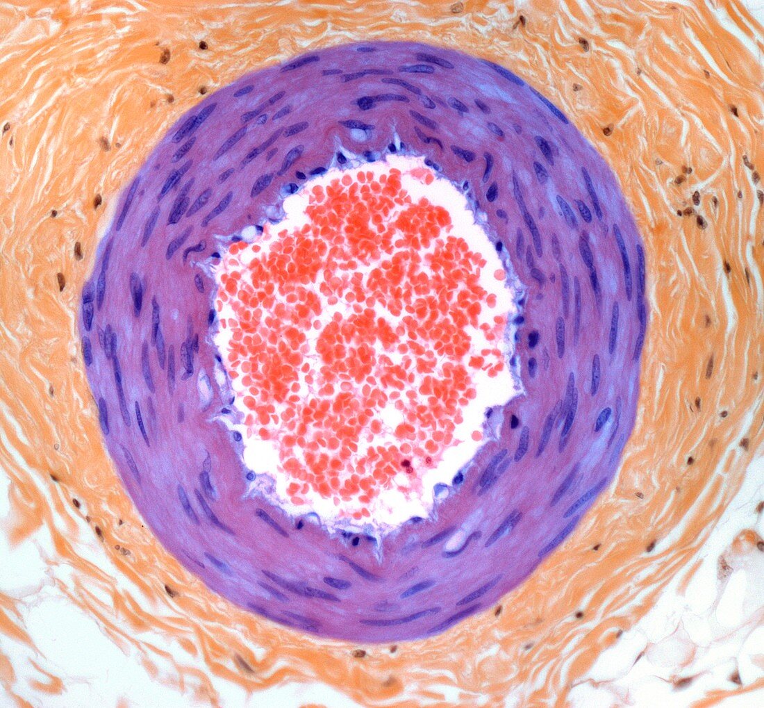 Arteriole blood vessel,light micrograph