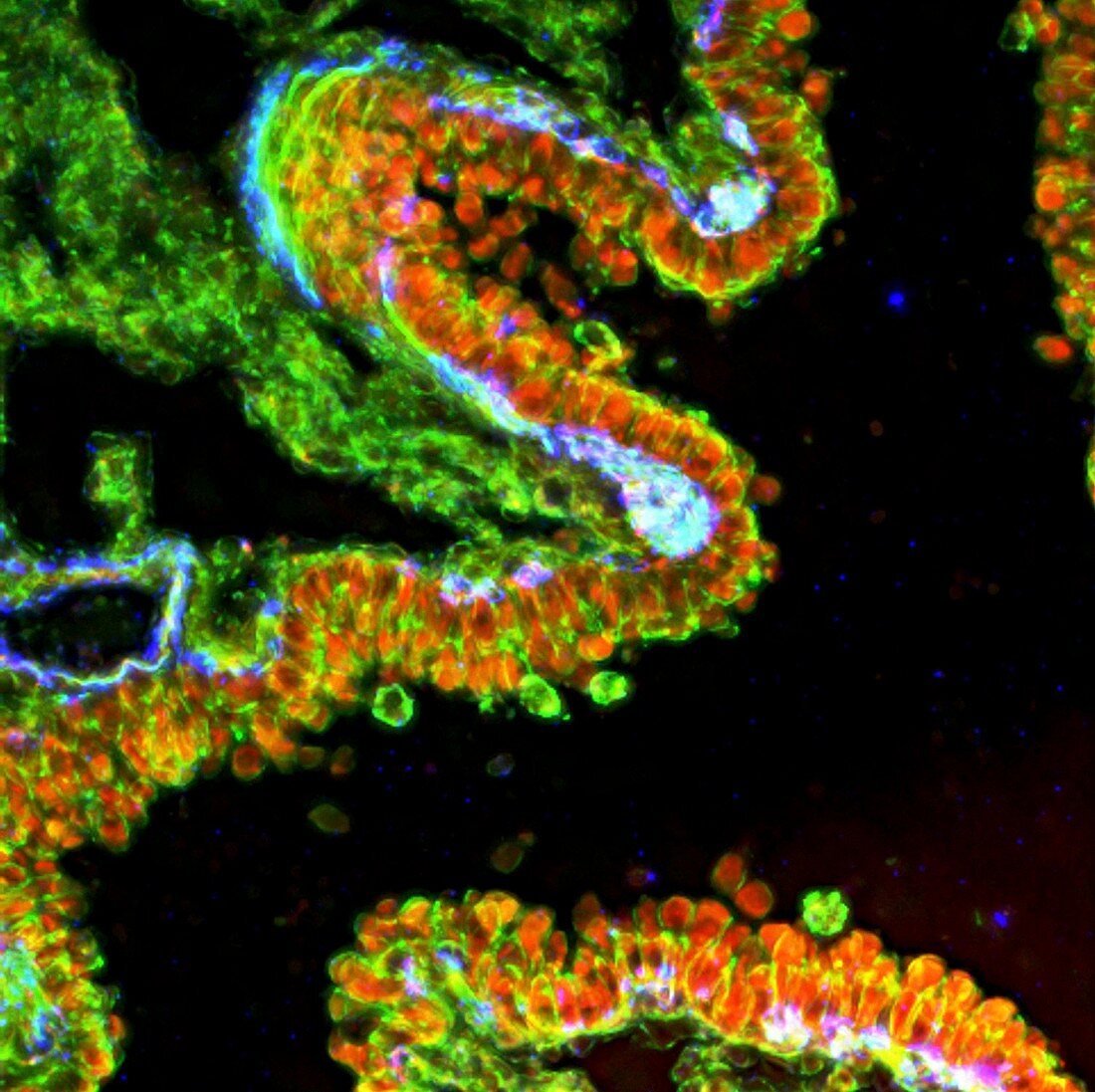 Lung bronchiole,fluorescence micrograph