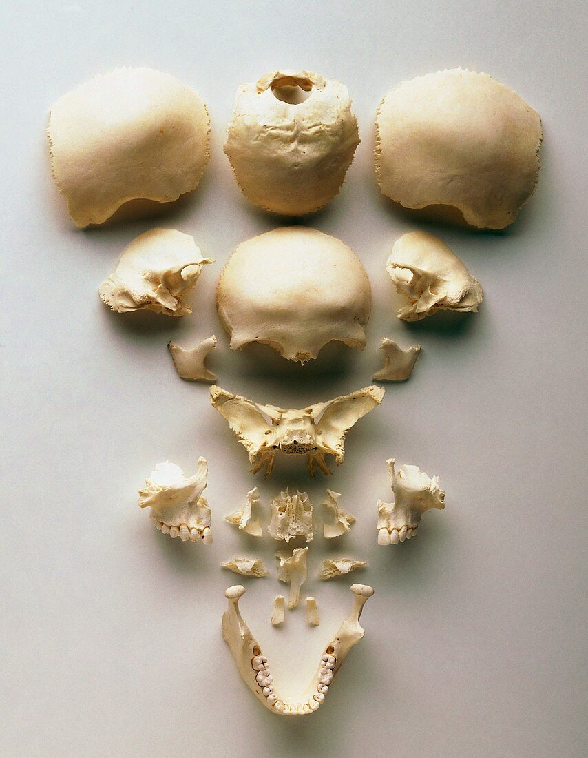 Human skull bones