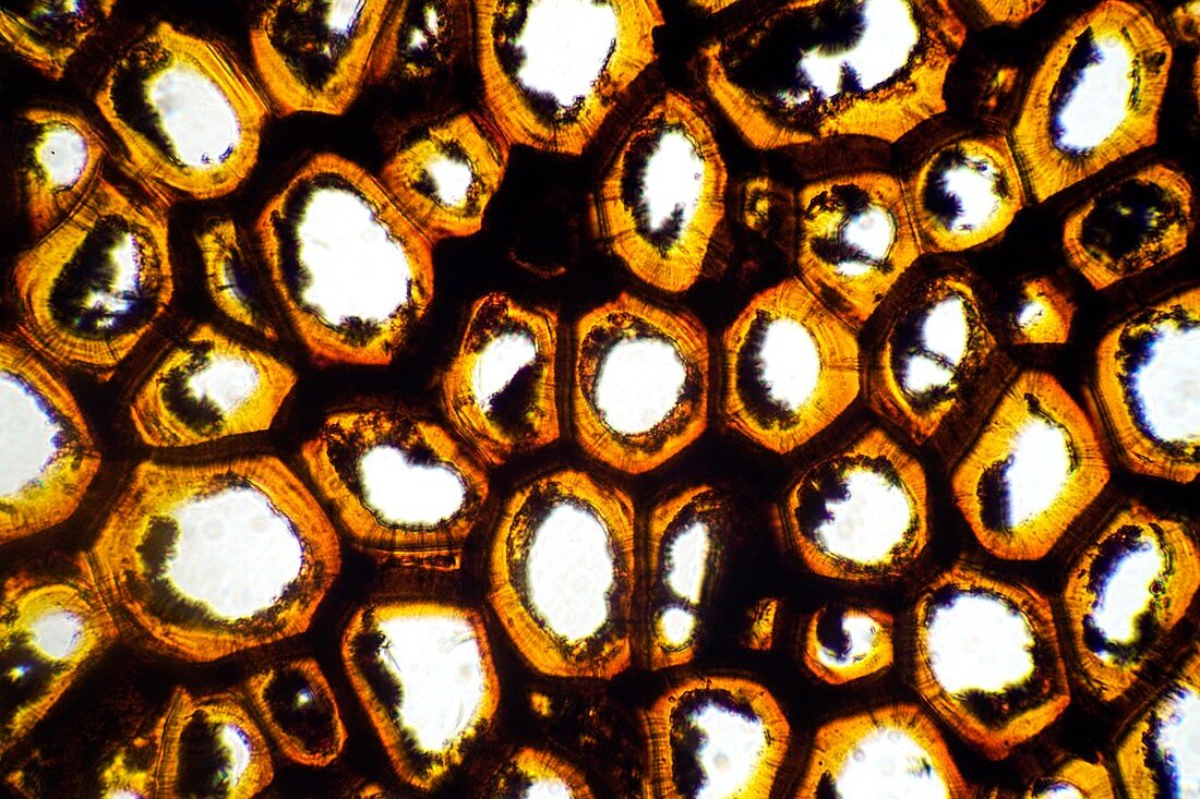 Strychnine tree nut,light micrograph