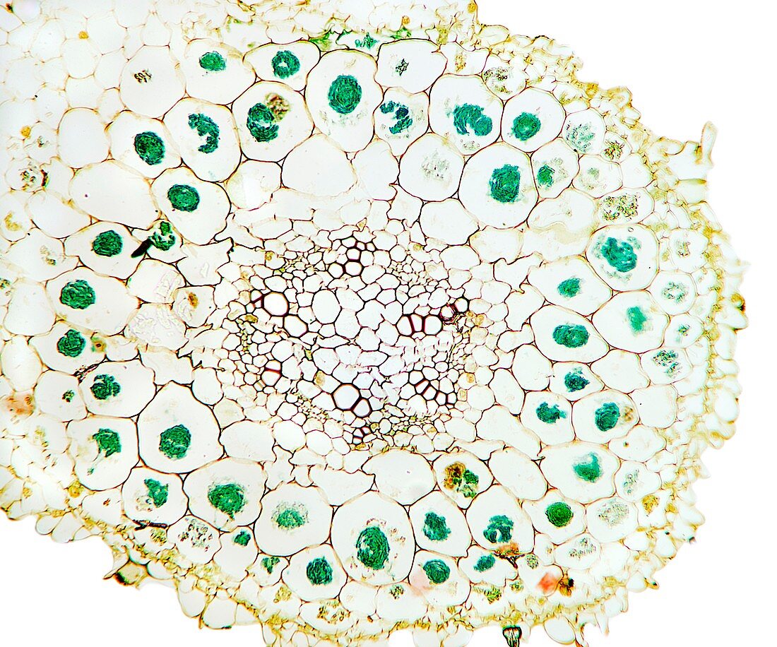 Orchid mycorrhiza,light micrograph