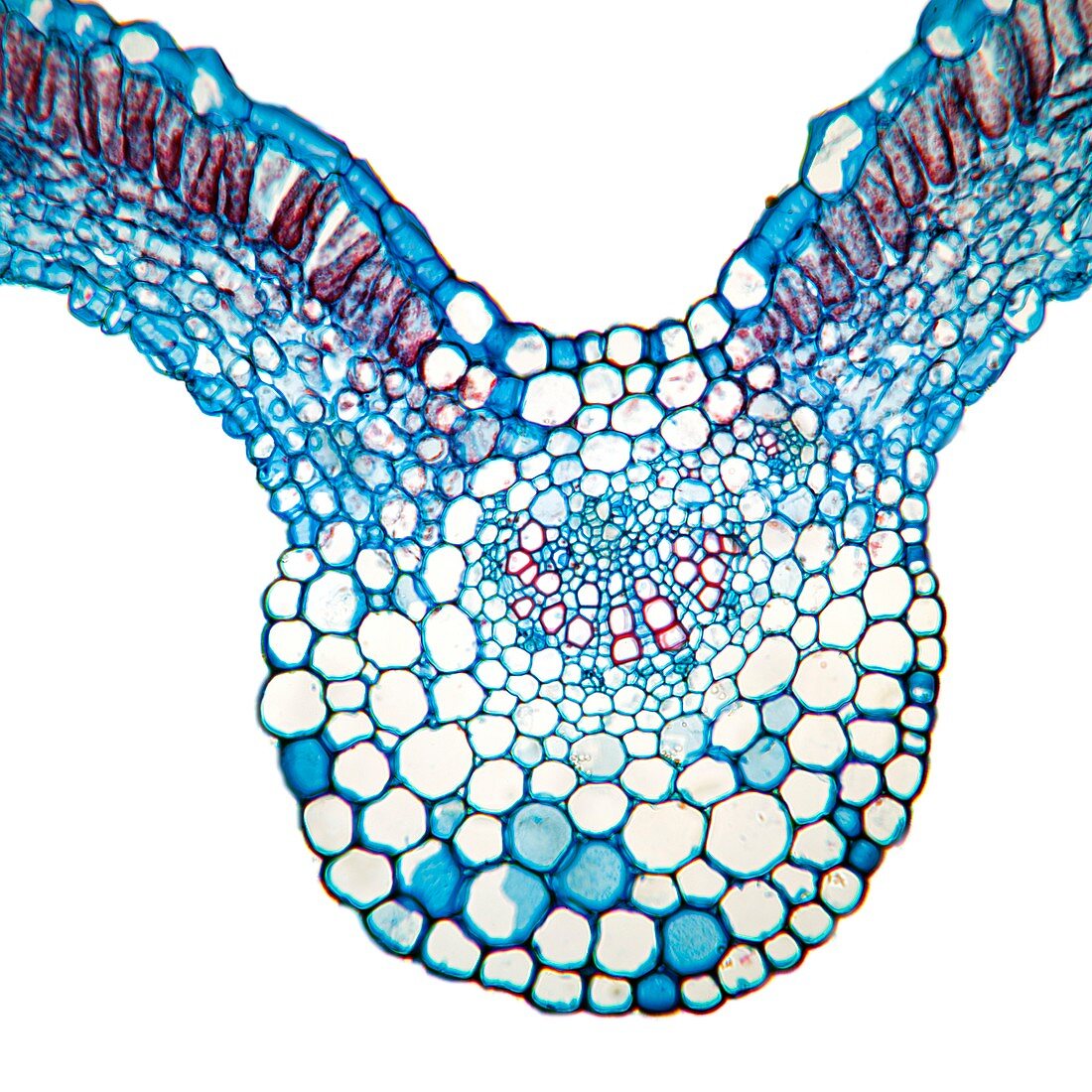 Meadow-beauty leaf,light micrograph