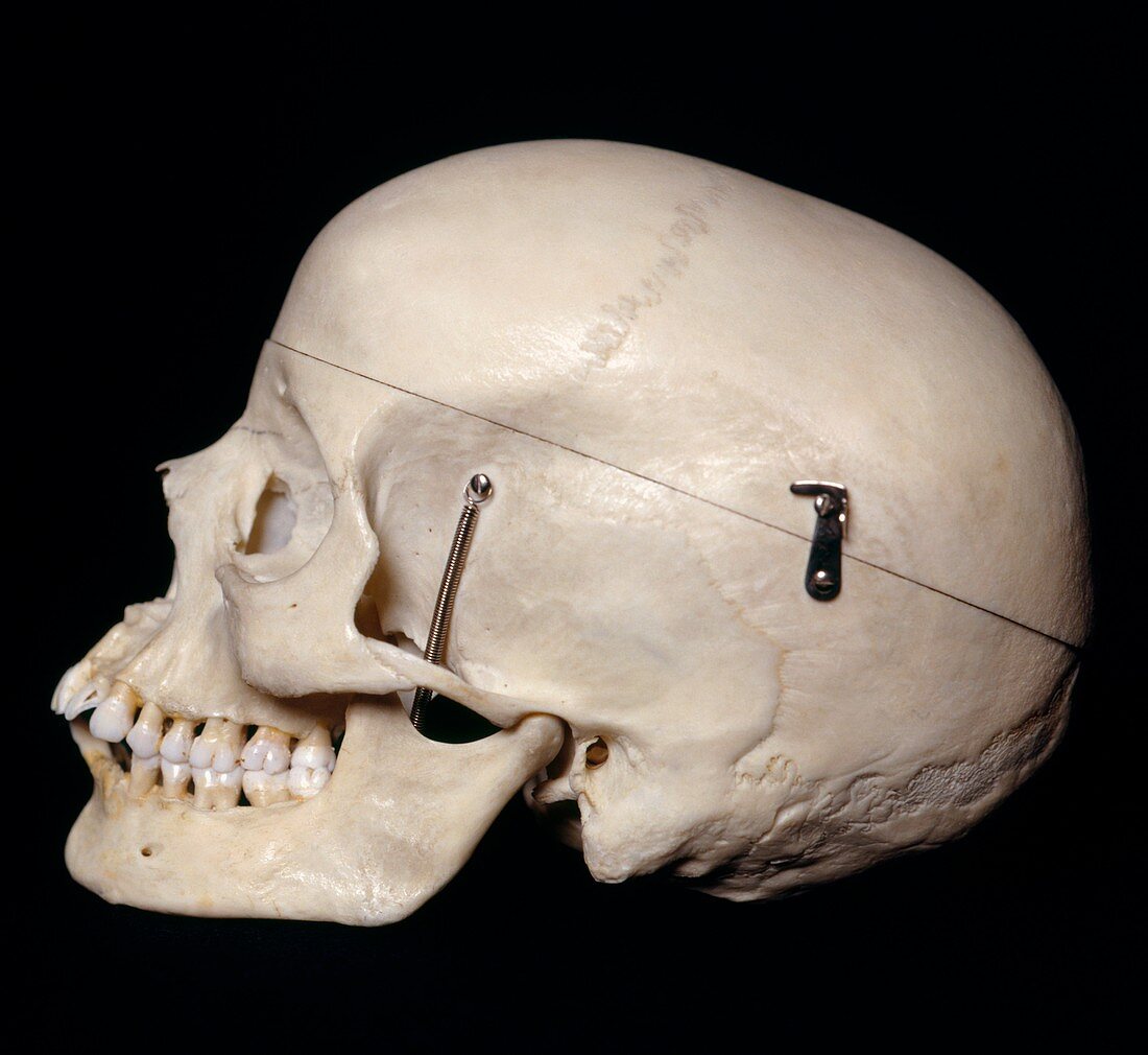 Female skull,side view