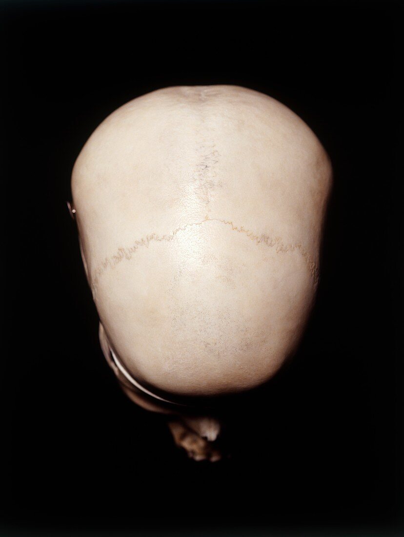 Female human skull