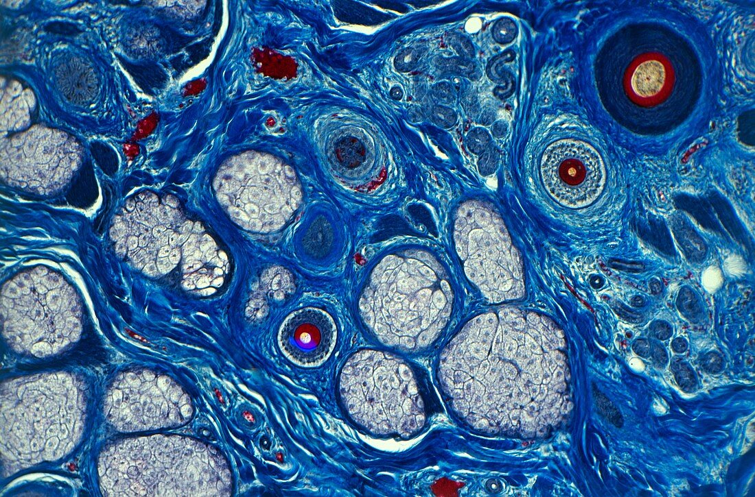 Human skin seen under a microscope