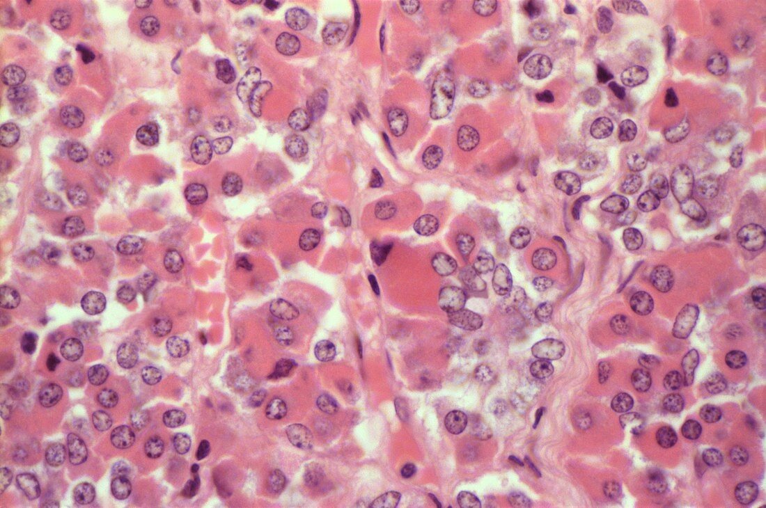 Pituitary cells stained with eosin