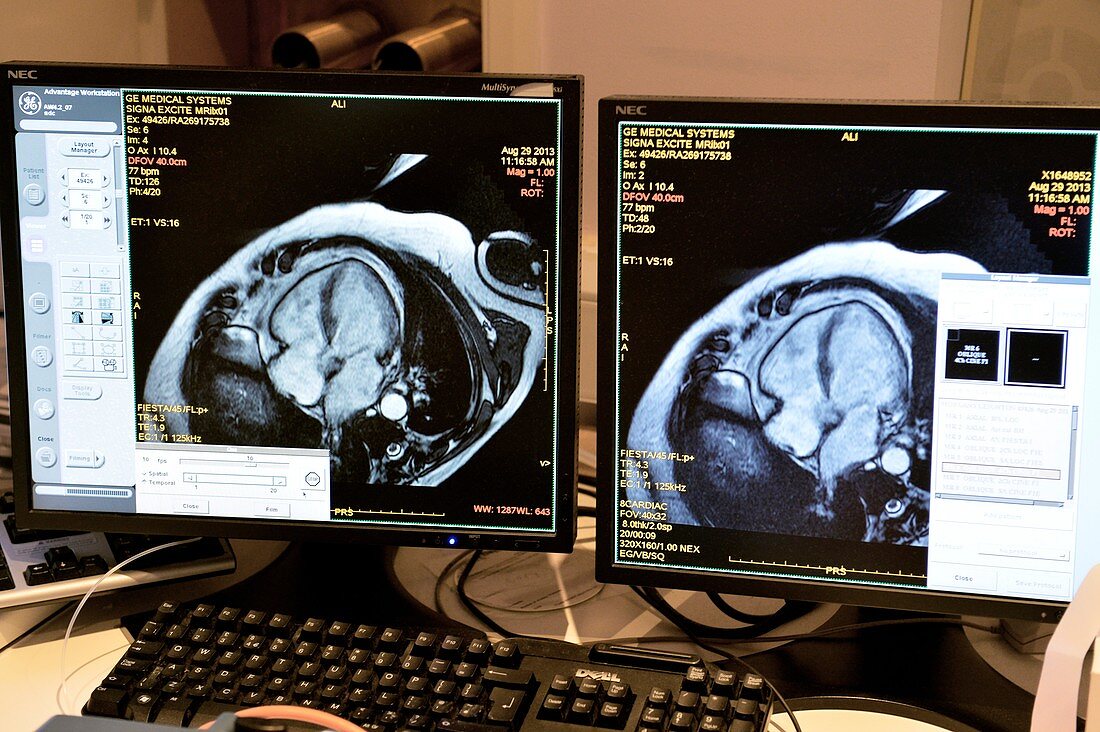 Cardiac MRI scanning