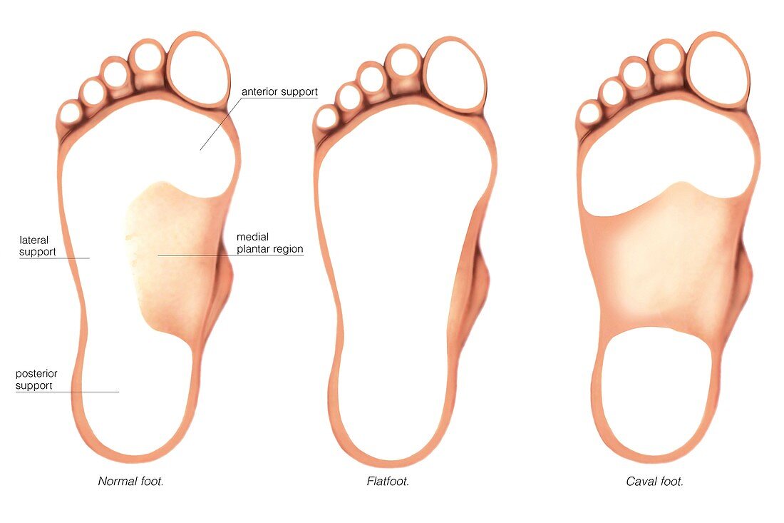 Anatomy regions of the foot,footprints