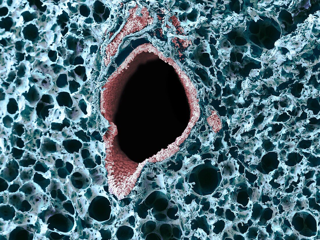 Lung tissue,SEM