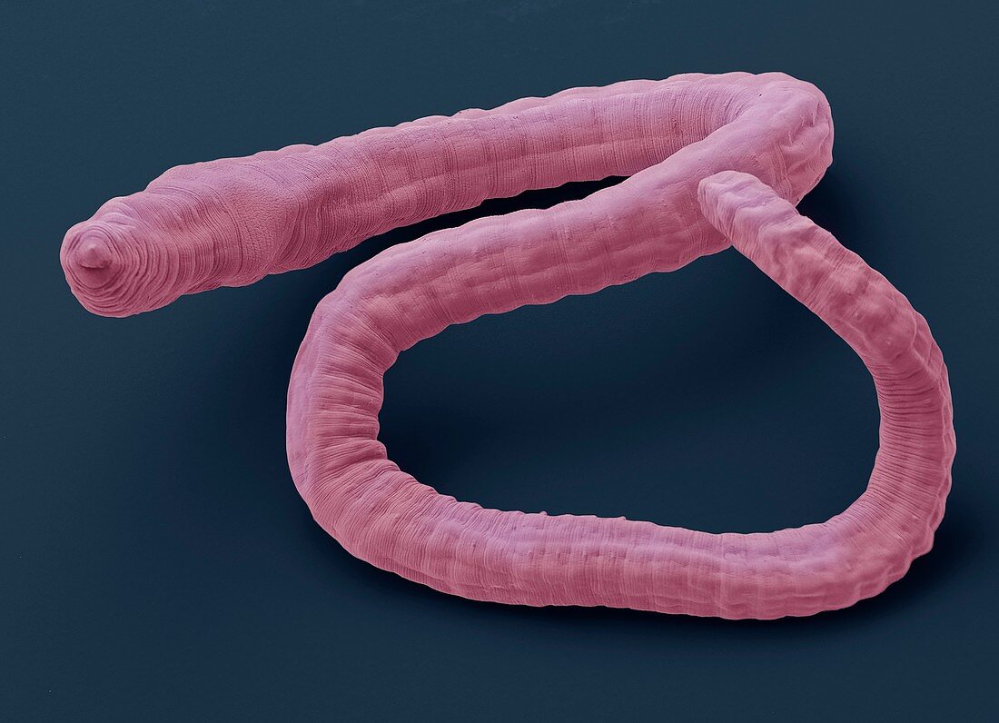 Tubifex worm,SEM