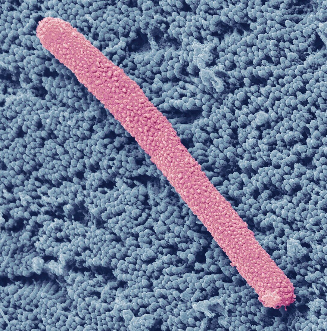 Bacterium in human appendix,SEM