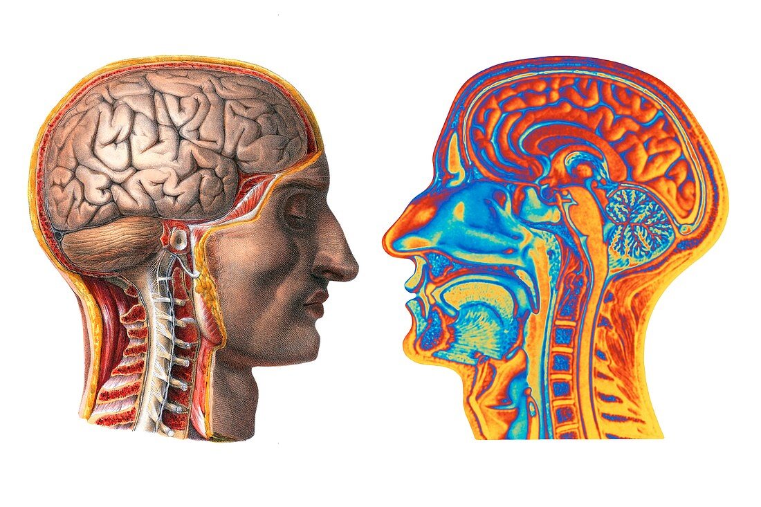 Brain,historical artwork and MRI scan