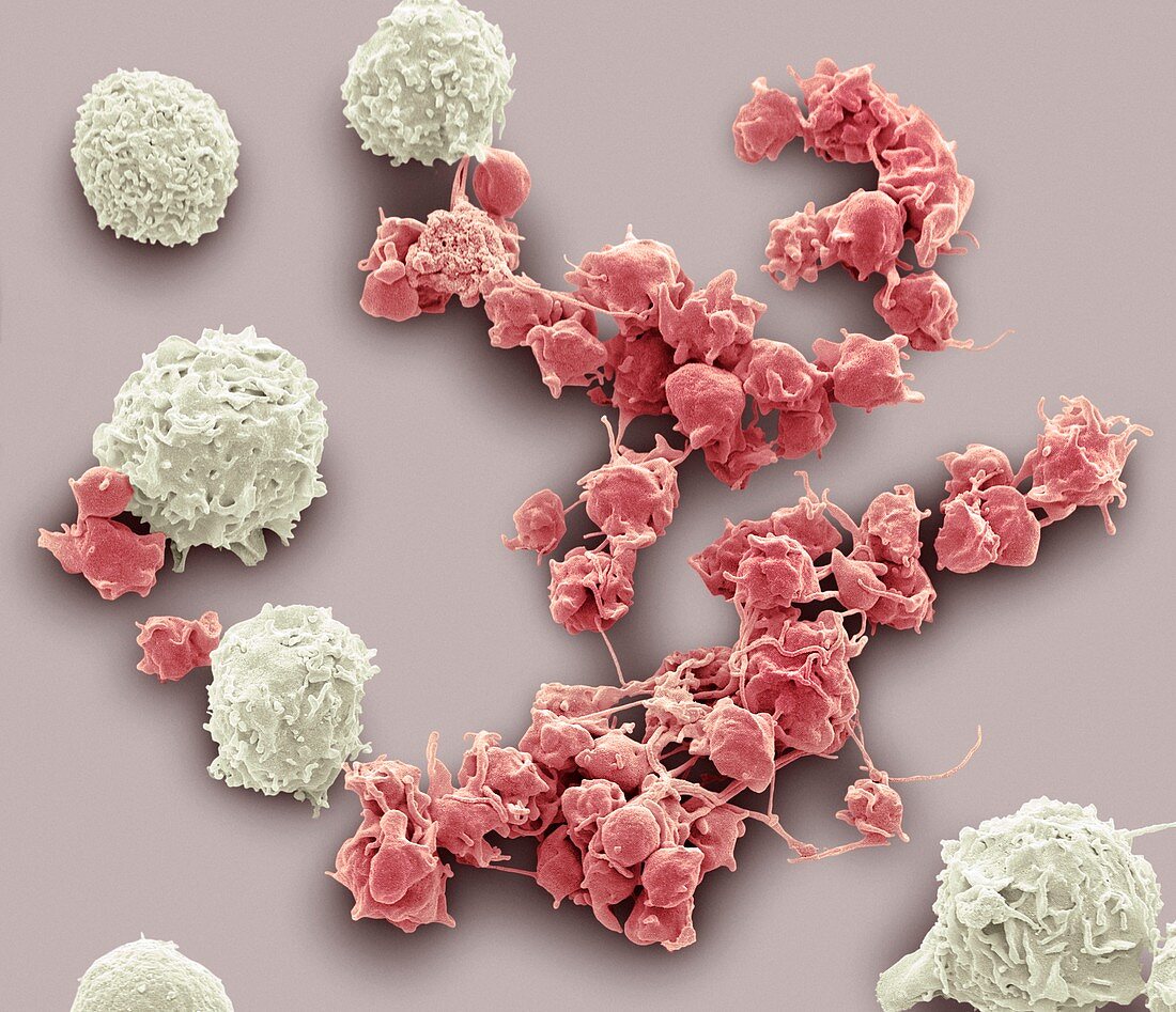 White blood cells and platelets,SEM