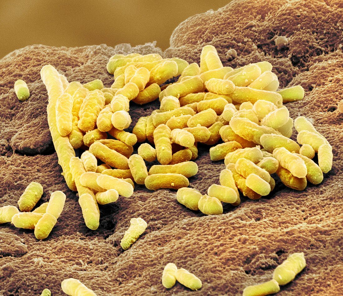 Lactobacillus bacteria,SEM