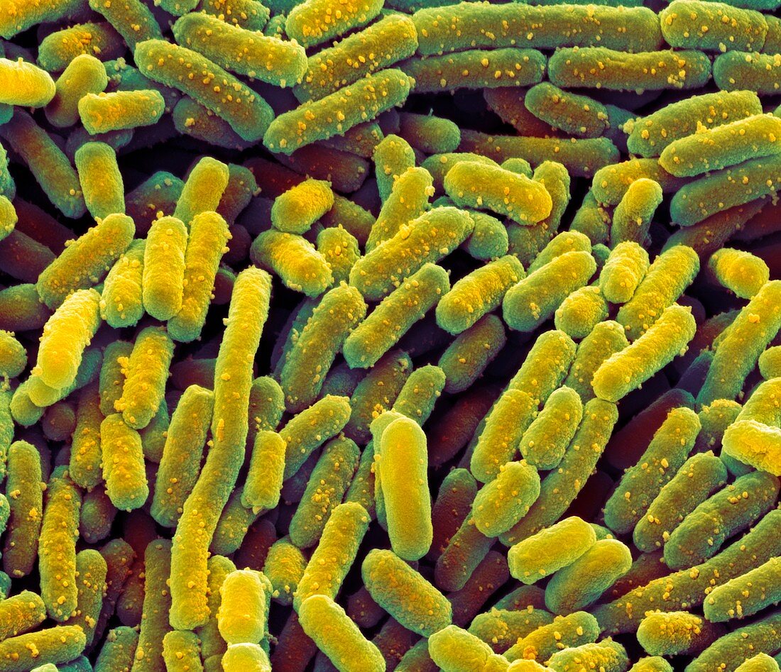 Lactobacillus bacteria,SEM