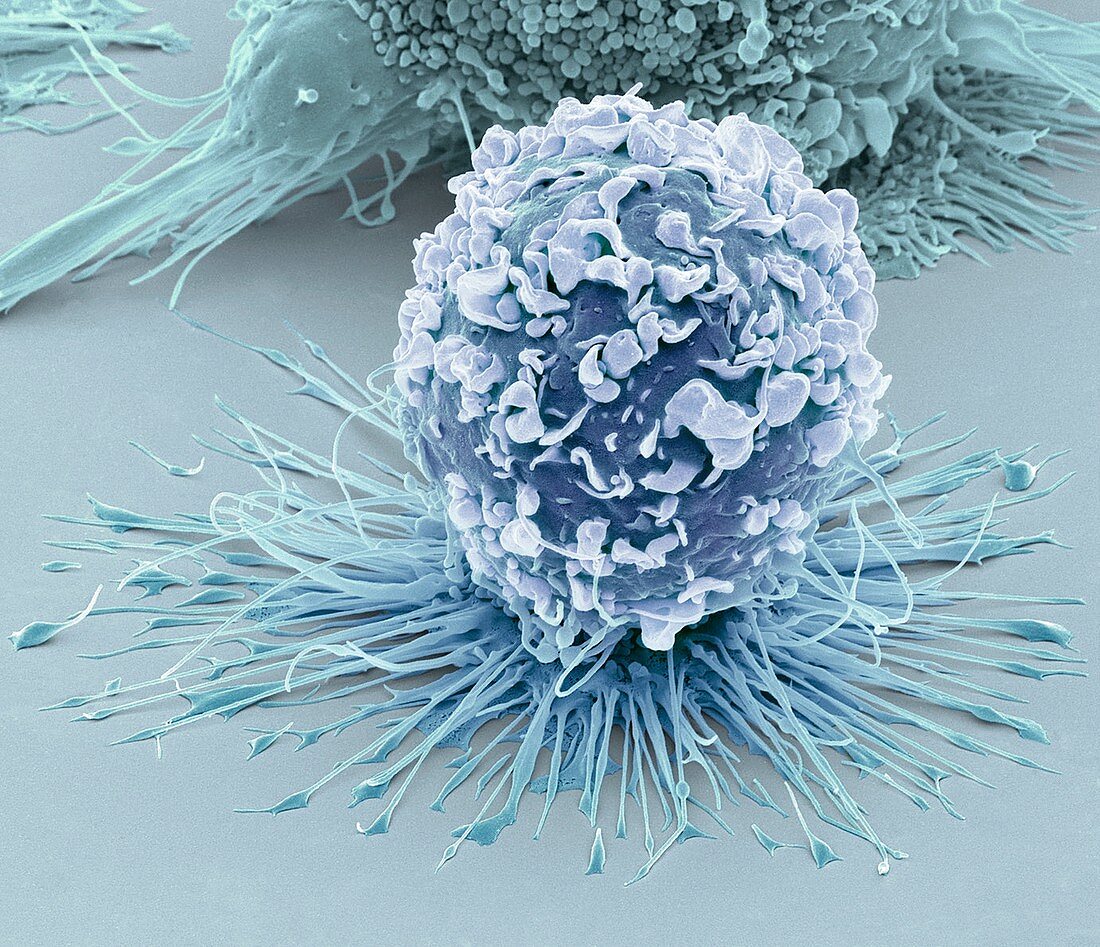 Activated macrophage,SEM