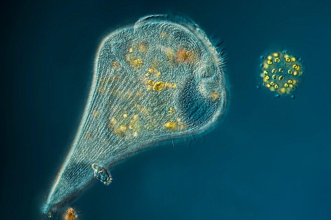 Stentor protozoan,light micrograph