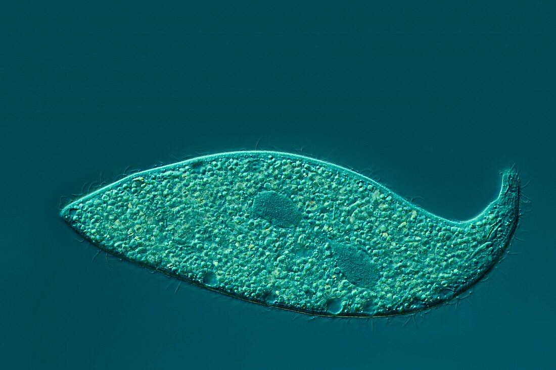 Ciliate protozoan,light micrograph