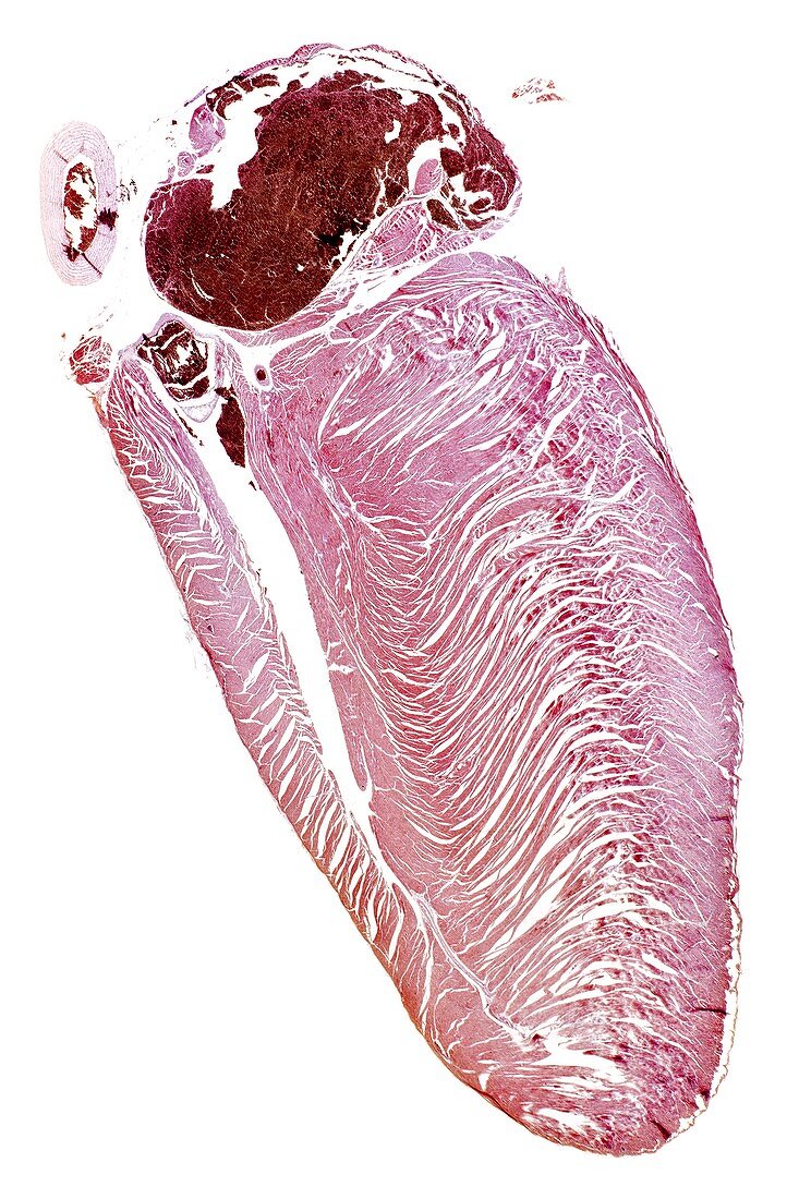 House martin heart,light micrograph