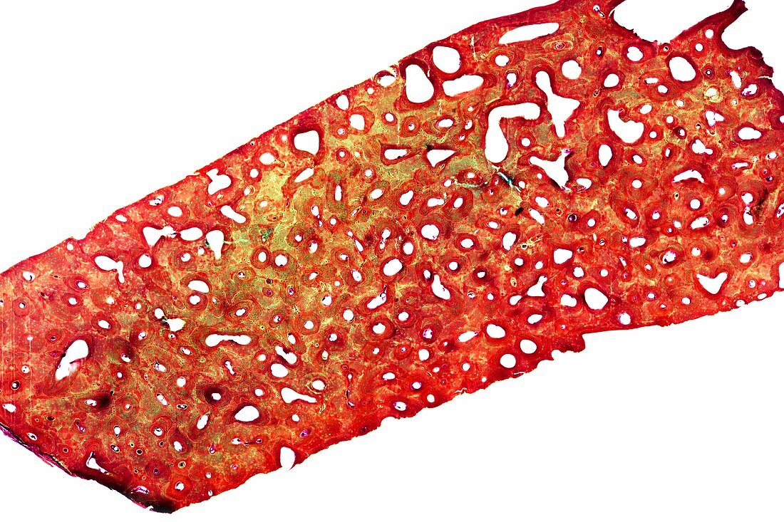 Decalcified bone,light micrograph