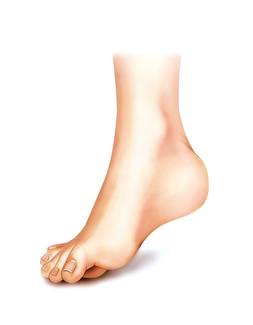 Foot deformations,artwork