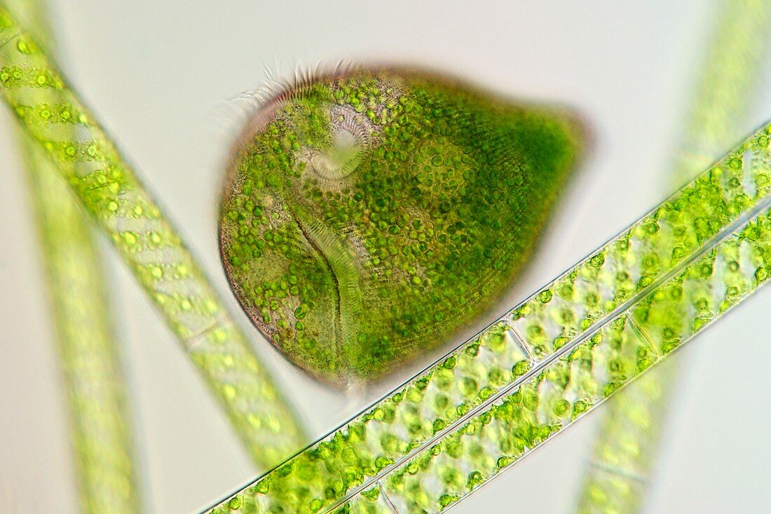 Stentor sp. protozoan,light micrograph