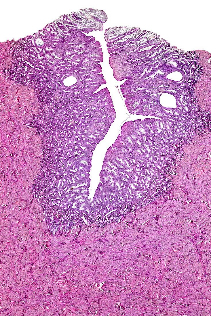 Human uterus,light micrograph