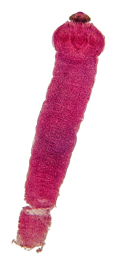 Tapeworm cysticercus,light micrograph