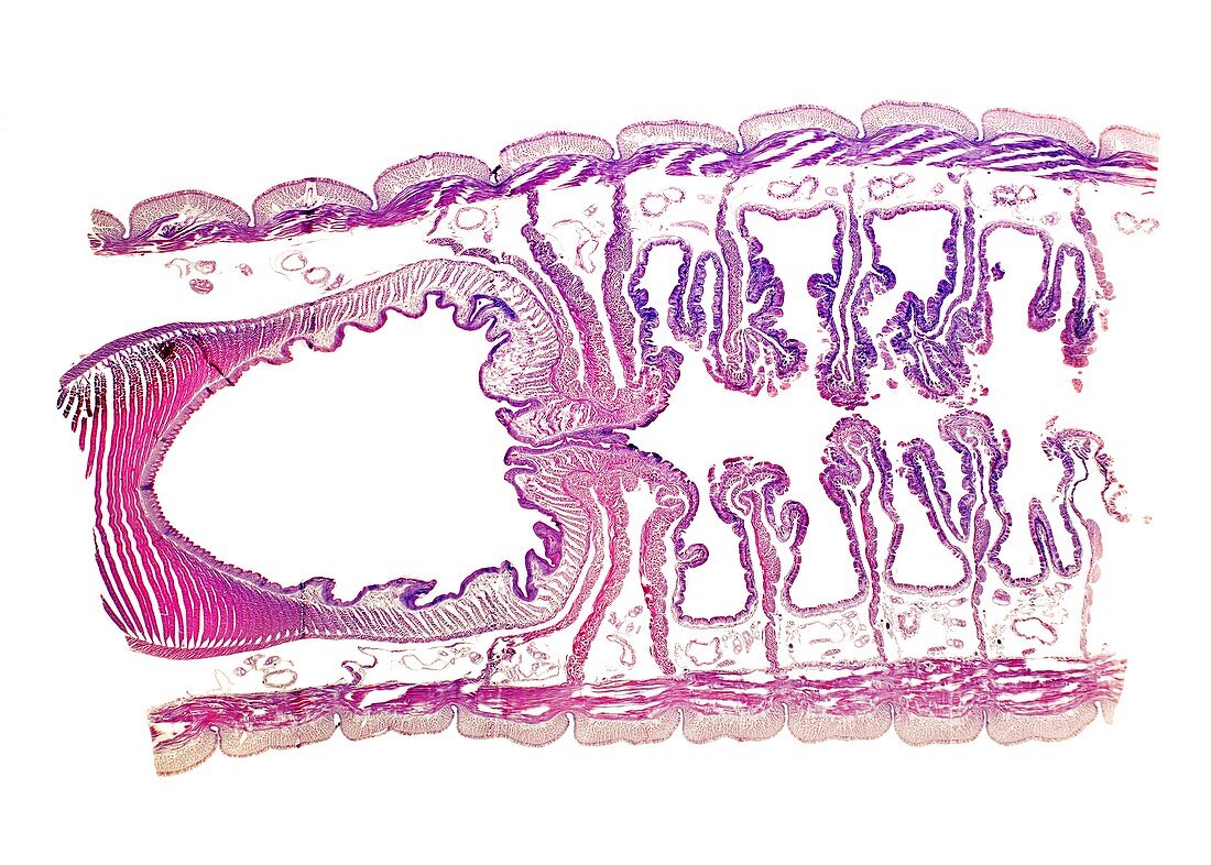 Earthworm,light micrograph