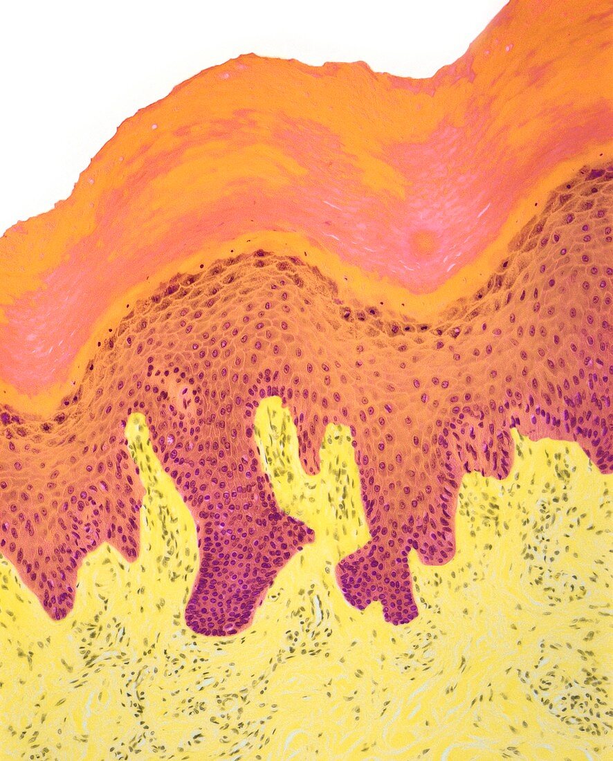 Skin of fingertip,light micrograph