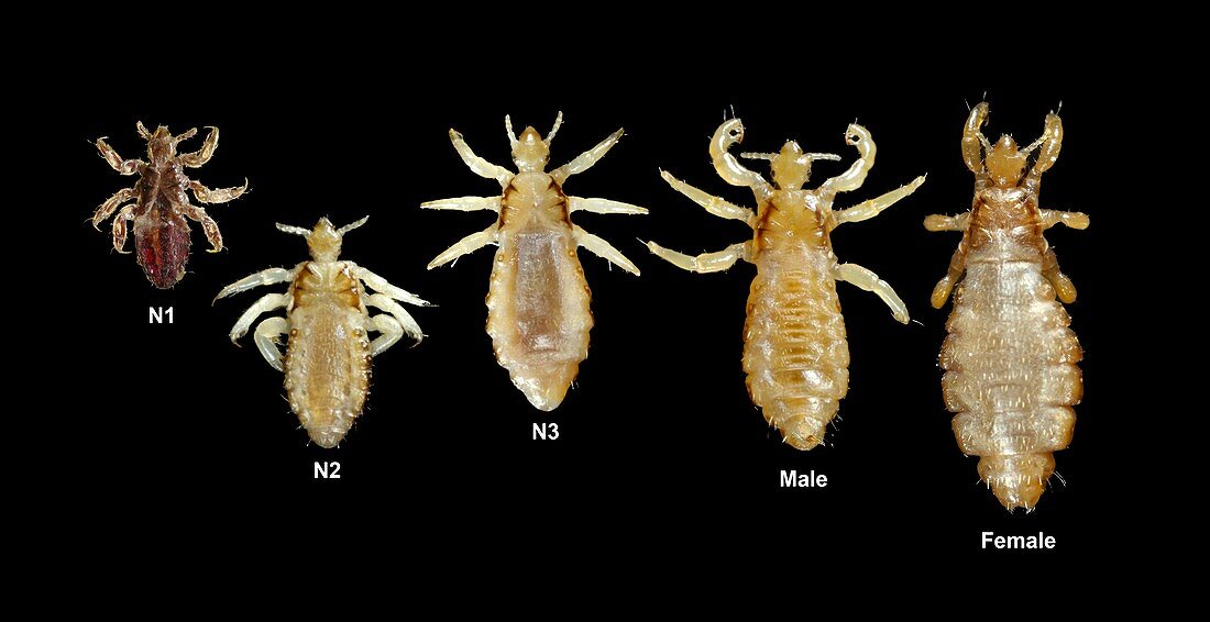 Body lice