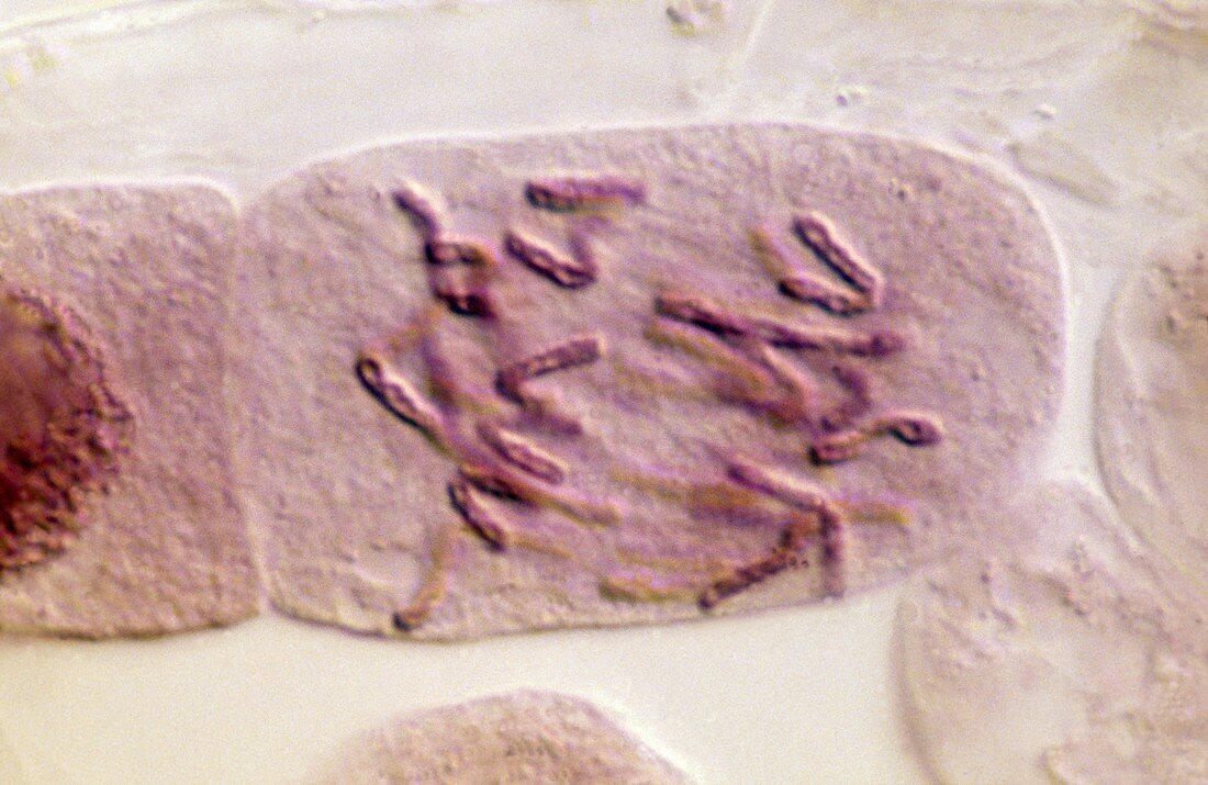 Plant cell undergoing mitosis,LM
