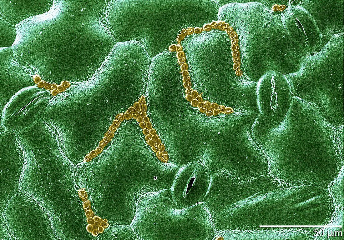 Cryptosporidium on a spinach leaf,SEM
