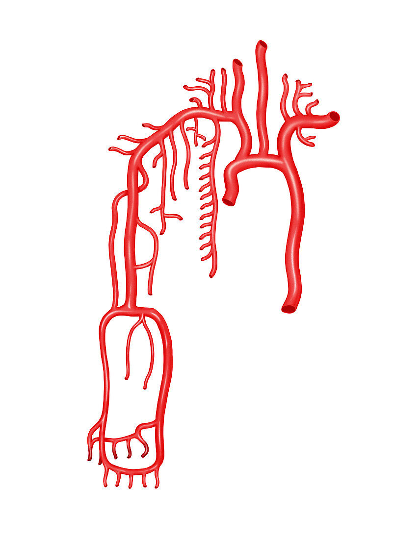 Arterial system of the upper body