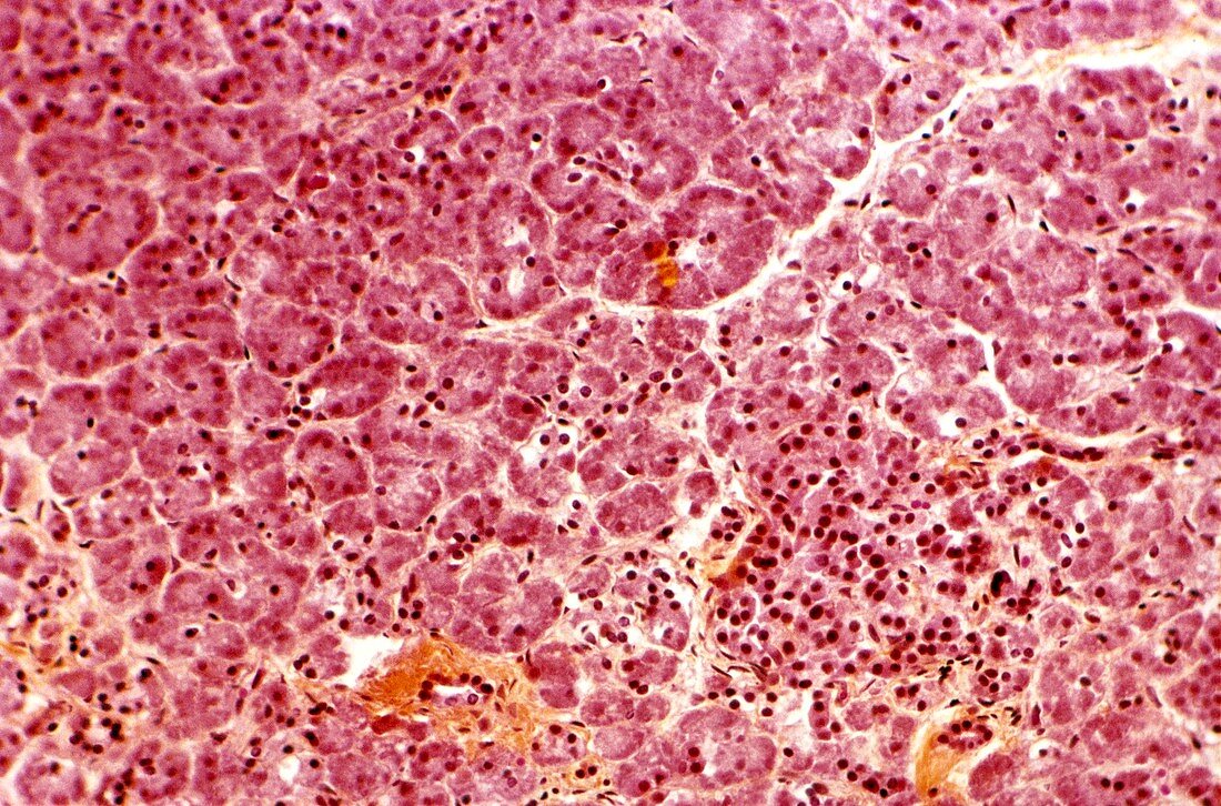 Pancreas,light micrograph