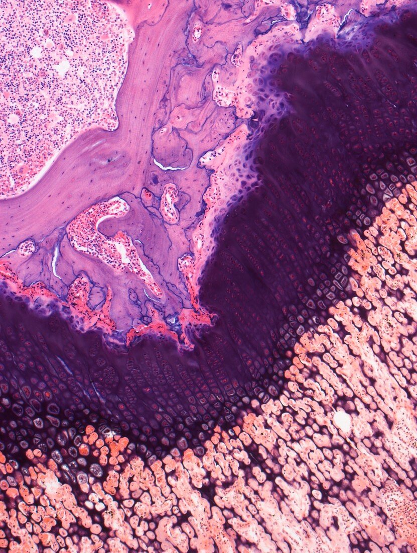Bone growth,light microscopy