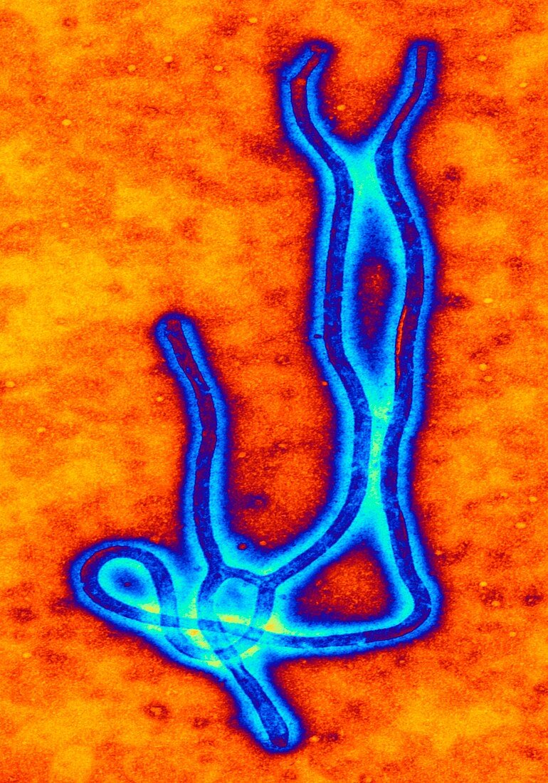Coloured TEM of the Ebola virus